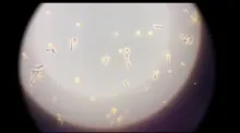 Pasantías con el microscopio